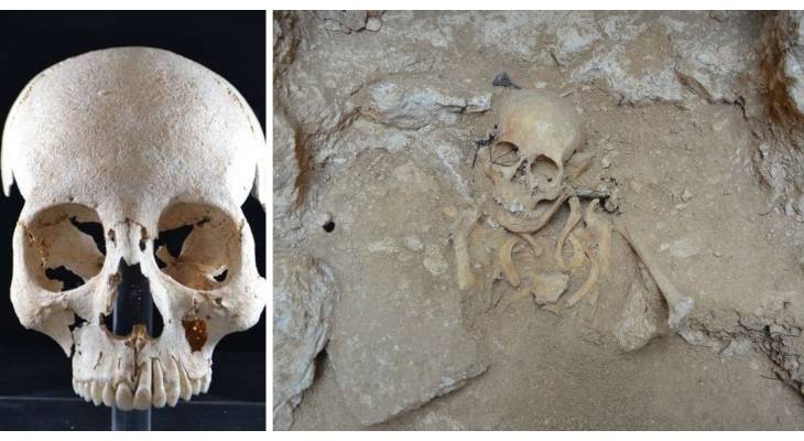 skeleton